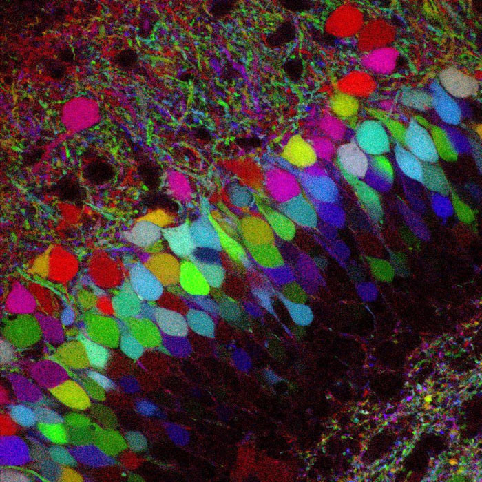 Neuroni di ratto visualizzati con la tecnica brainbow