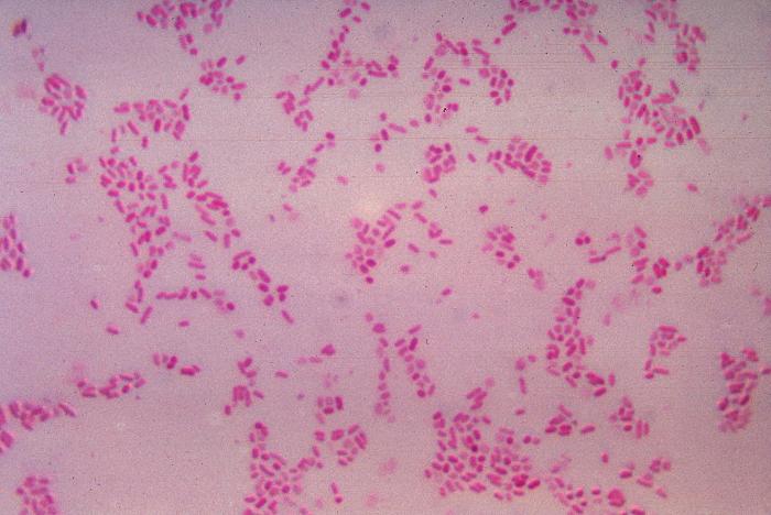 BacteroidesFragilis_Gram