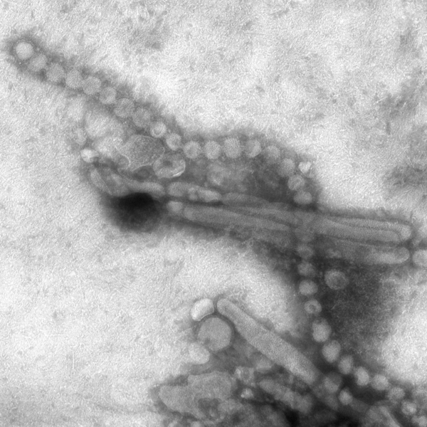 600px-Electron_micrograph_of_Influenza_A_H7N9