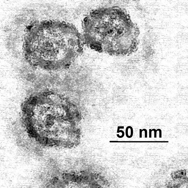 600px-Em_flavavirus-HCV_samp1c
