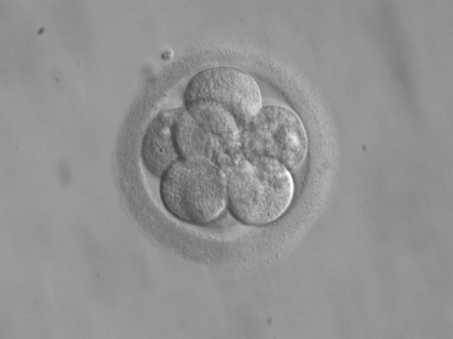 http://commons.wikimedia.org/wiki/File:Embryo,_8_cells.jpg?uselang=it