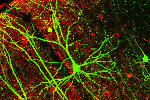 http://commons.wikimedia.org/wiki/Neuron?uselang=it#mediaviewer/File:PLoSBiol4.e126.Fig6fNeuron.jpg