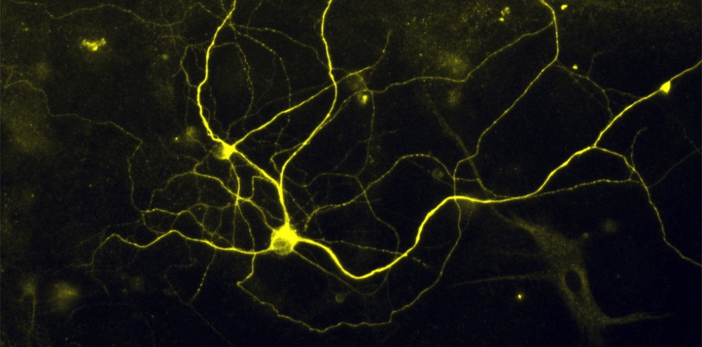 nociceptorweb