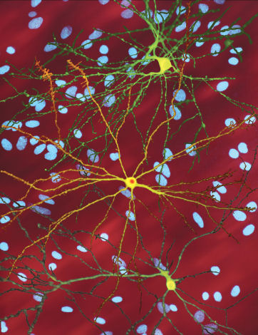 Neuron_with_mHtt_inclusion