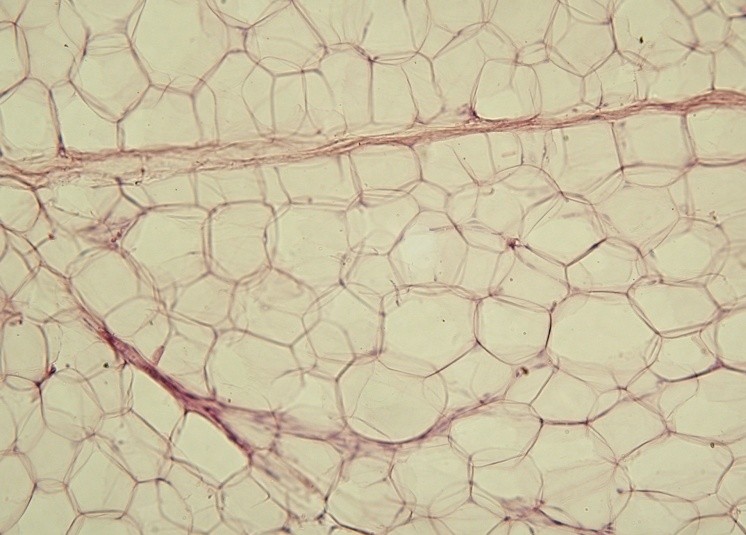 Yellow_adipose_tissue_in_paraffin_section_-_lipids_washed_out