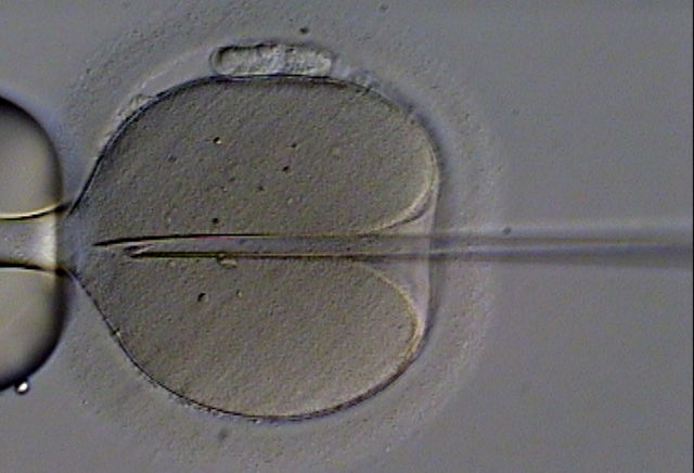 http://de.wikipedia.org/wiki/In-vitro-Fertilisation#mediaviewer/File:ICSI.jpg