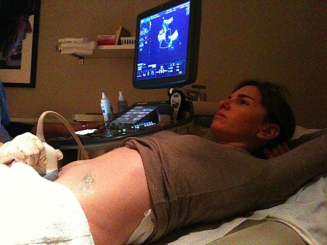 http://en.wikipedia.org/wiki/Prenatal_nutrition#/media/File:Ultrasound_examination_of_woman.JPG