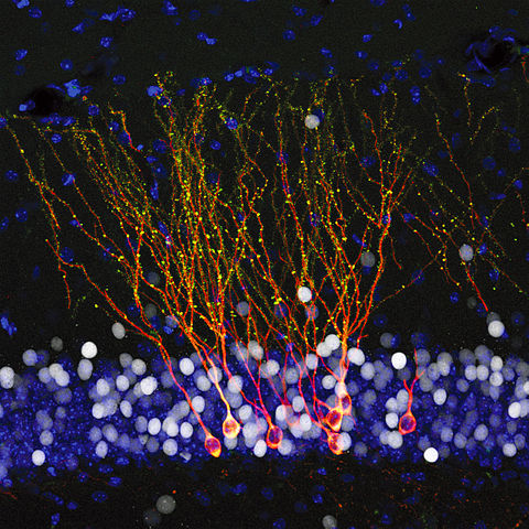 480px-Retrovirus_labeled_granule_neurons_in_the_dentate_gyrus_of_Alzheimer_disease_mouse_model.