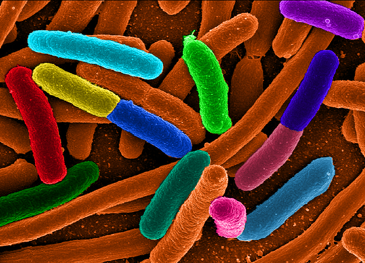 Diverse_e_Coli