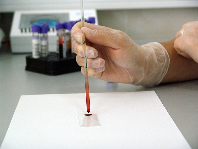 contagio-hiv-laboratori-sicurezza