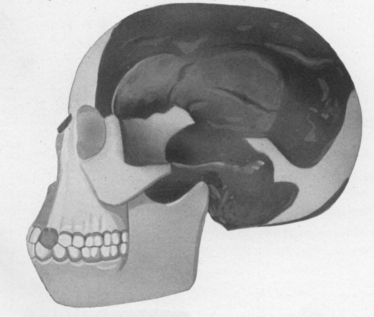 Piltdown_man