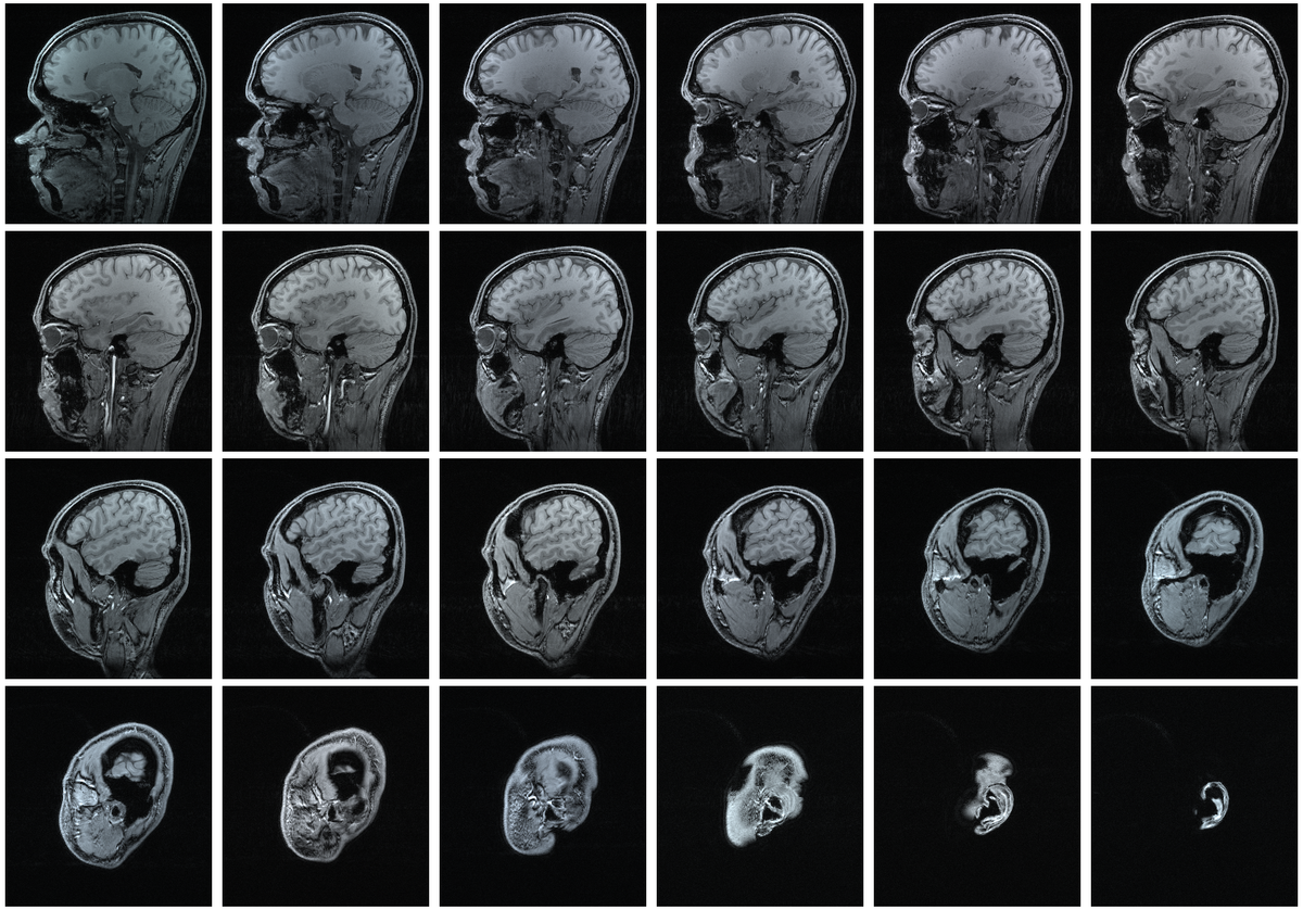 1200px-mri